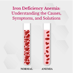 Iron Deficiency Anemia: Understanding the Causes, Symptoms, and ...